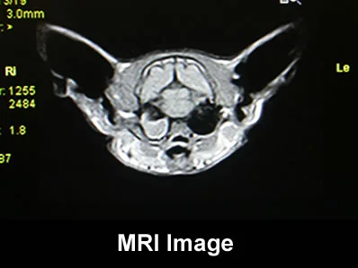 mri1.jpg