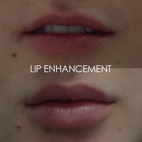 Lip enhancement &amp; Line smoothing