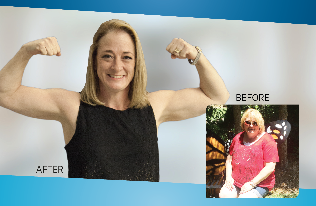 Kelli Dean lost 105 lbs after having the Lap Band procedure at Saline Health System.