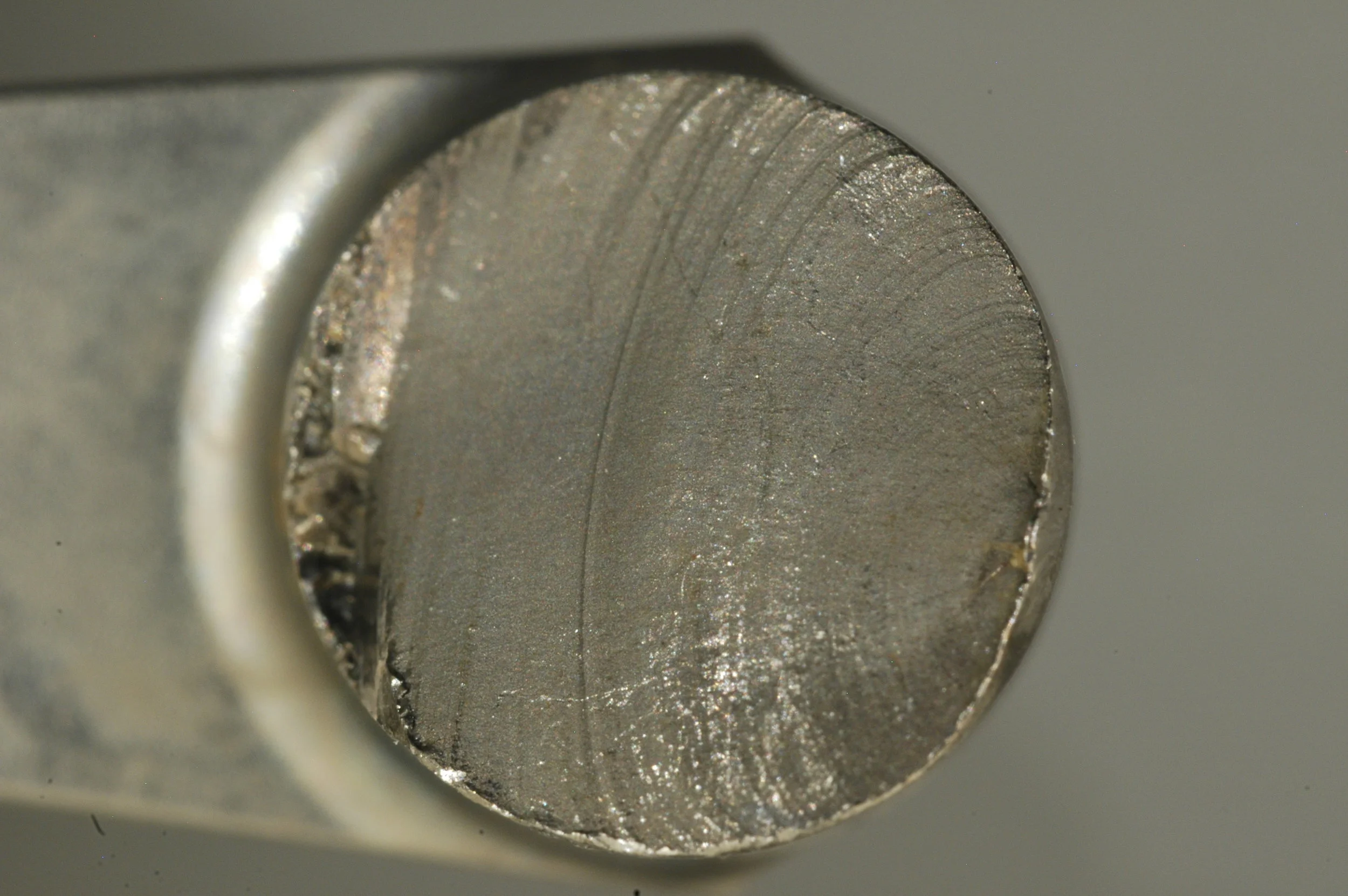 Hip Implant Fracture