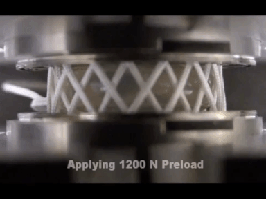 Spinal Implant Patent