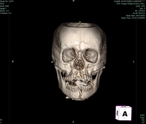 3D Anatomy