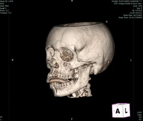 3D Anatomy