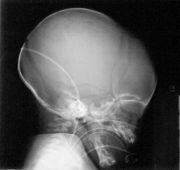 Baby_Xray_small.jpg