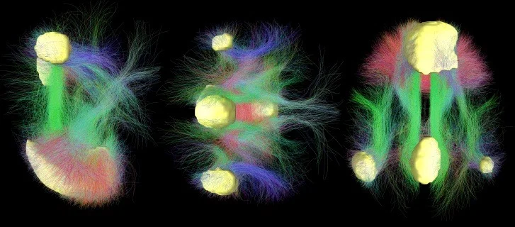 Someone sciency got their tech on and made this pretty image of the default mode network for us. Well, for Wikipedia. They made it for Wikipedia. Image via: https://bit.ly/2McwDdU