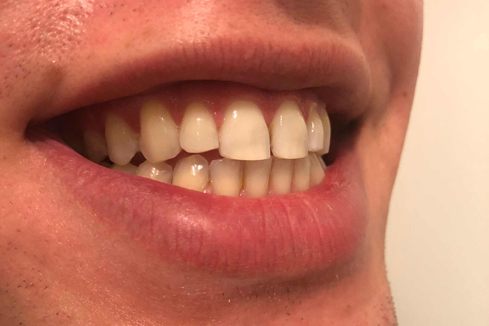 Smile+2.jpg