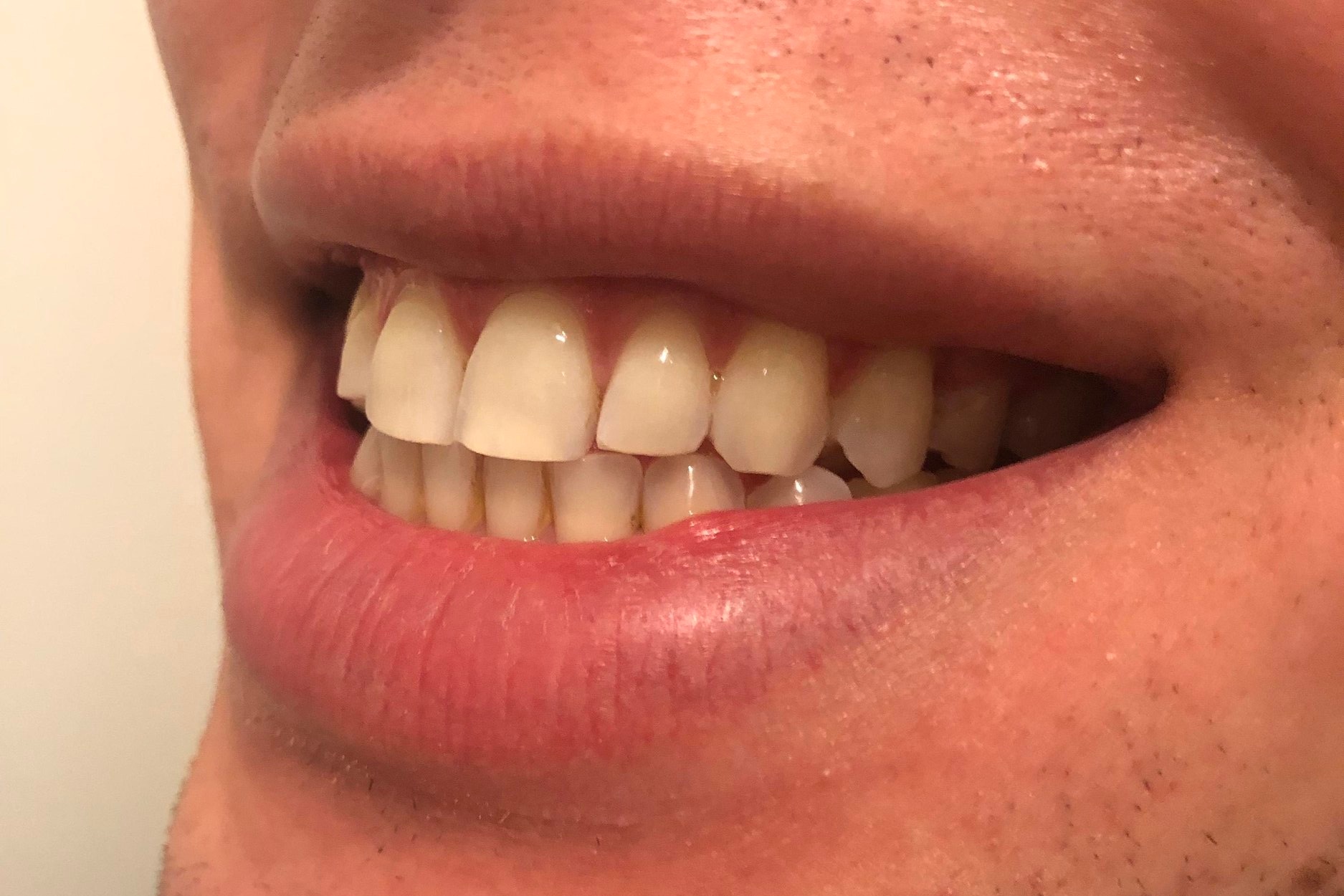 Smile+3.jpg