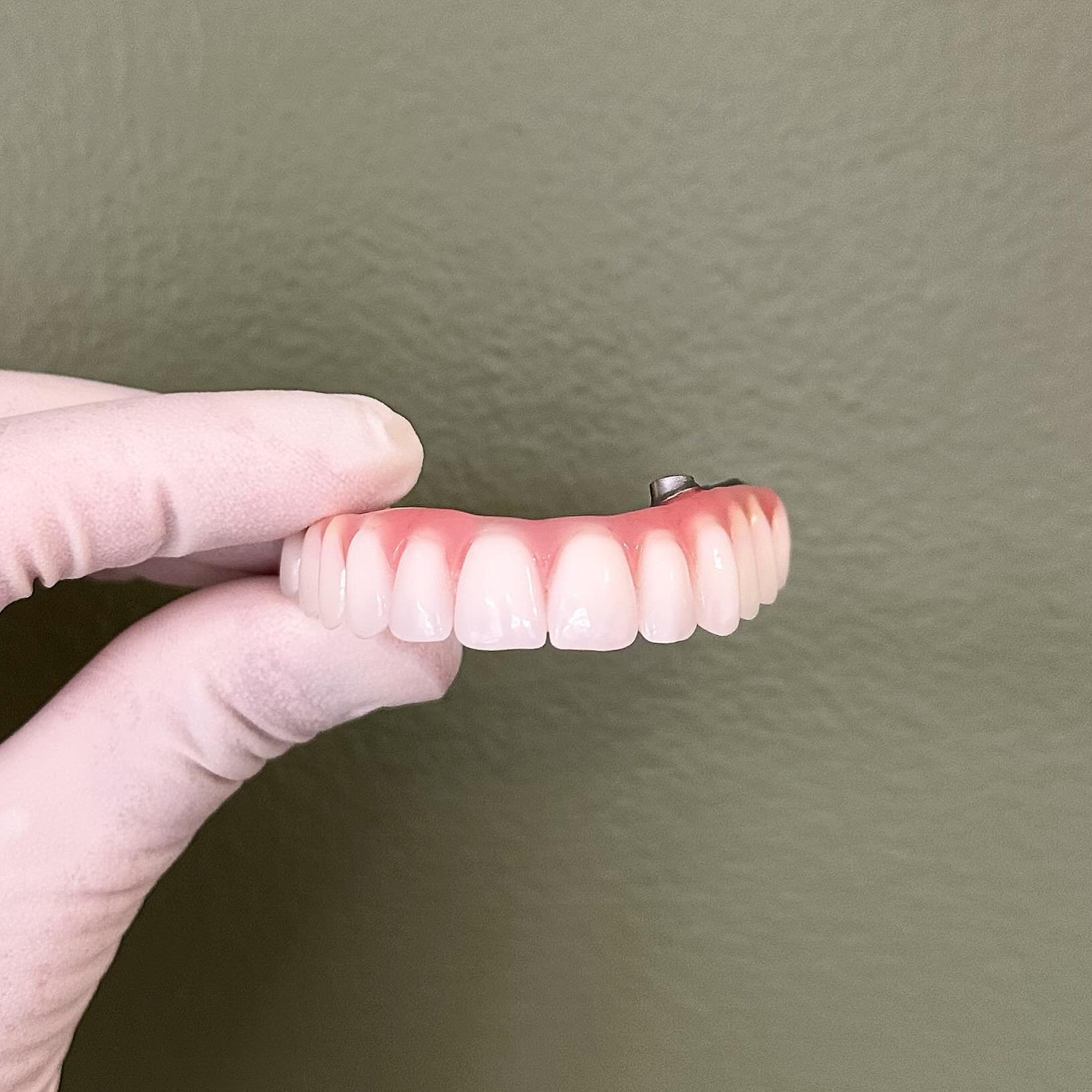 Hold that smile&hellip; 📸 
Day of fit for an all-on-6 😃 
Smiling, eating and talking with confidence 💪🏻
.
#implants #teamwork