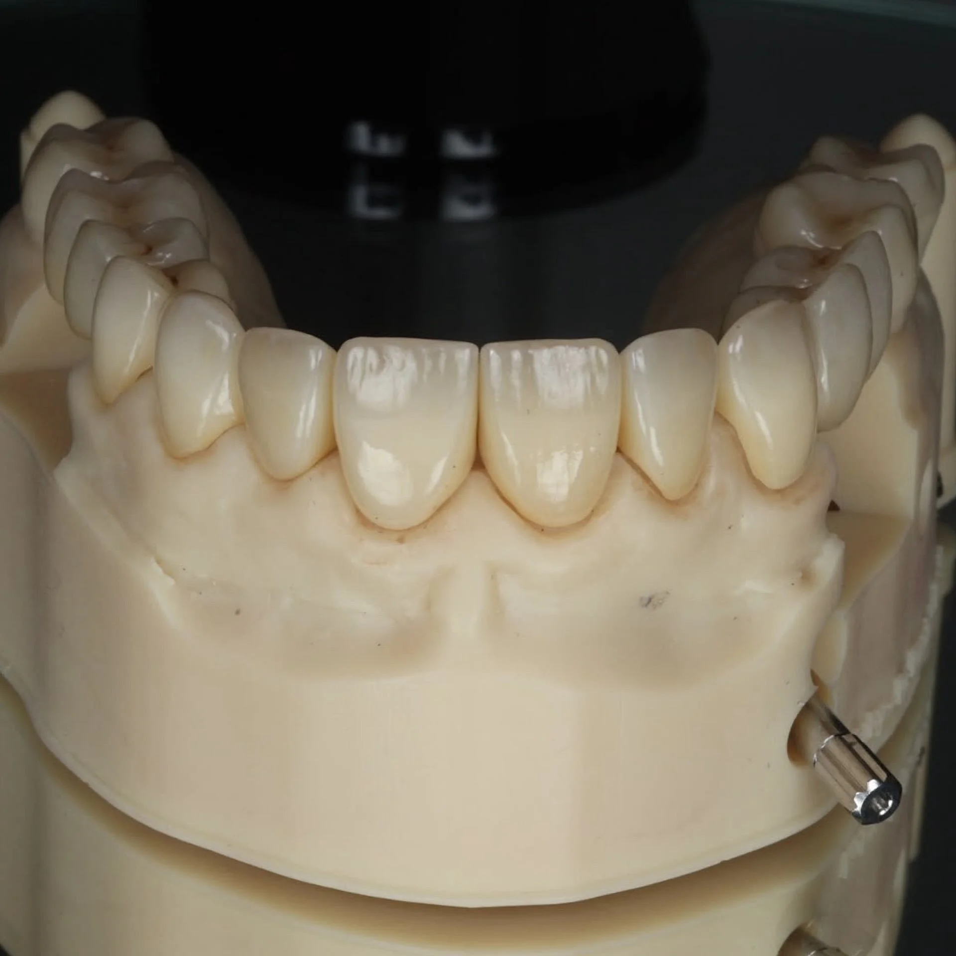 Chris X @drdanielgillen X @zenithlabs.uk 
Implants X Restorative X #dentallab in symbiosis 
Full mouth rehabilitation @onebyonedental ♾️ 
Can&rsquo;t wait to see the final clinical pictures 👌👍🏻