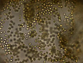 MIcrocystis.jpg