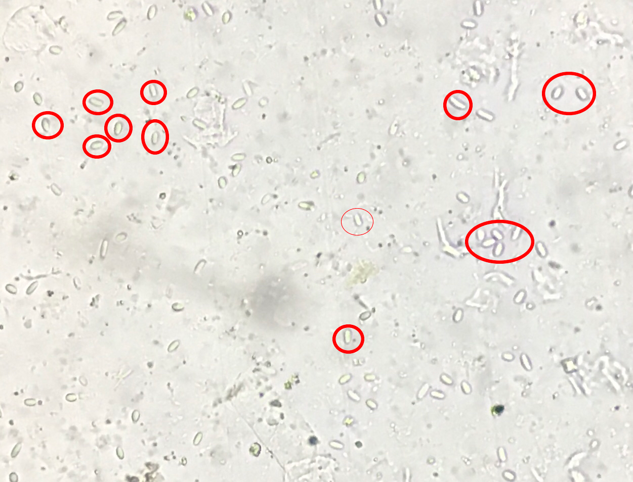 Nosema spores - examples highlighted in red