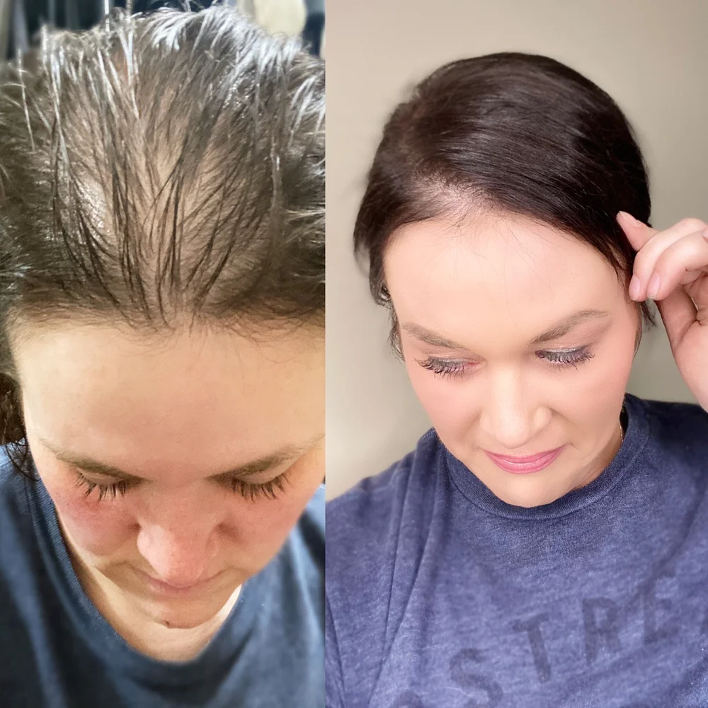 Surface awaken stimulate and revitalize for thinning hair set town