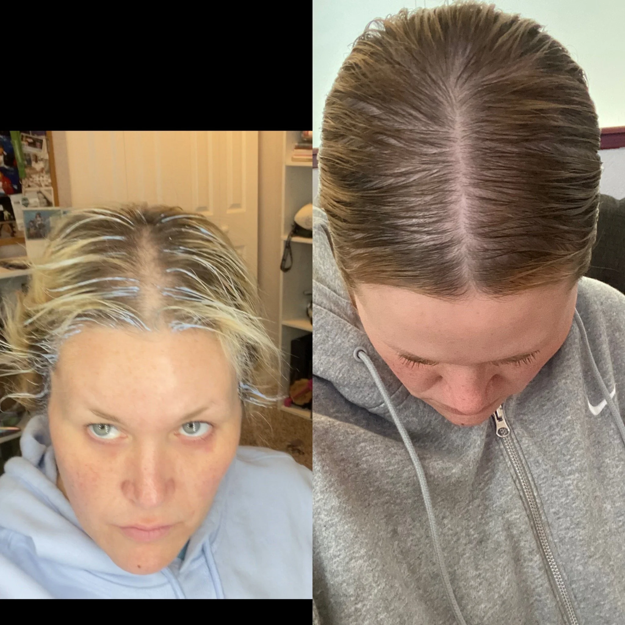 How to Grow Thicker Hair