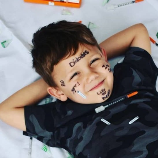 Du-Handré Blignaut: It makes life better for not just me but for those looking after me.