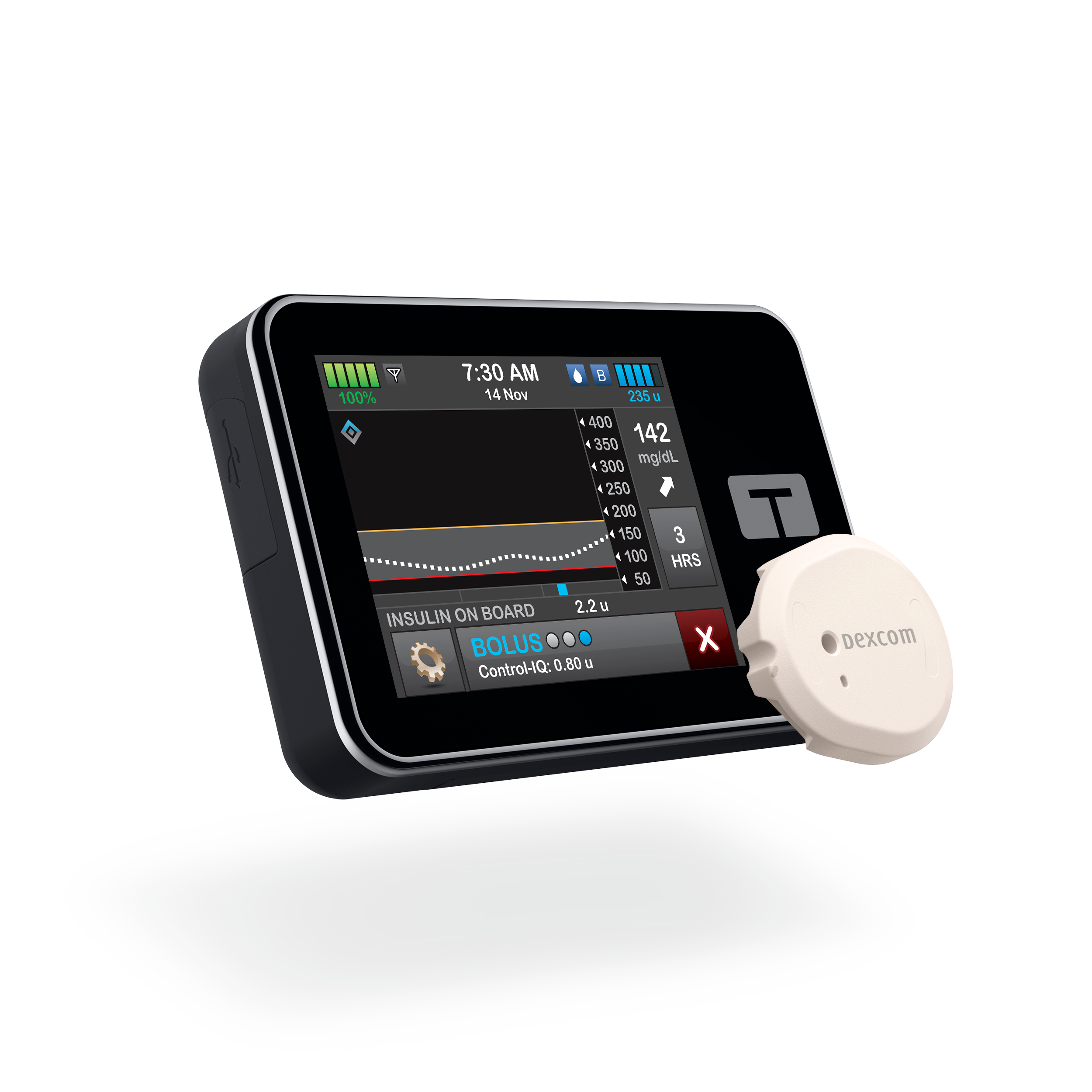 Diabetes Tech Access May Save Thousands from Amputations &amp; Vision Loss - Data