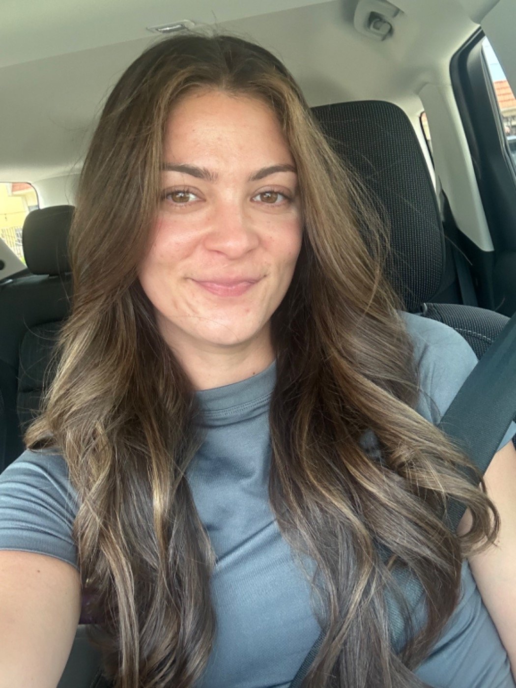 Faleesha Kiss Acne Goodbye Real Client