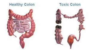 Overall health begins in the colon.