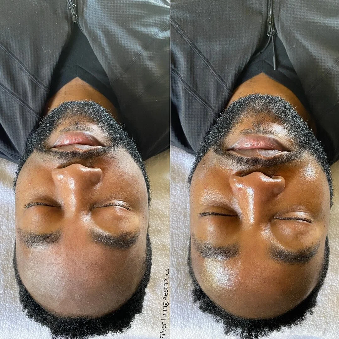 Let&rsquo;s normalize men getting facials 🙌🏾
Because they deserve amazing skin too

He got a Diamond Microderm Facial

BENEFITS of  DIAMOND Microdermabrasion

- Remove Dead Skin
- Remove Pollen and Debri
- Softer Skin
- Improve Skin Texture 
- Bett