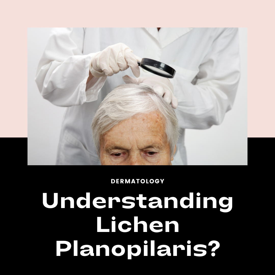Understanding Lichen Planopilaris - Simplified!
