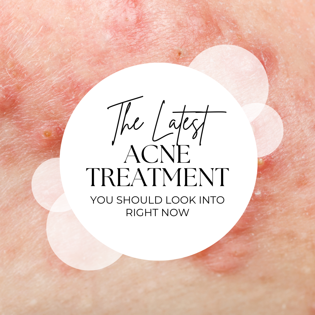 Introducing the Latest Acne Treatment in Australia