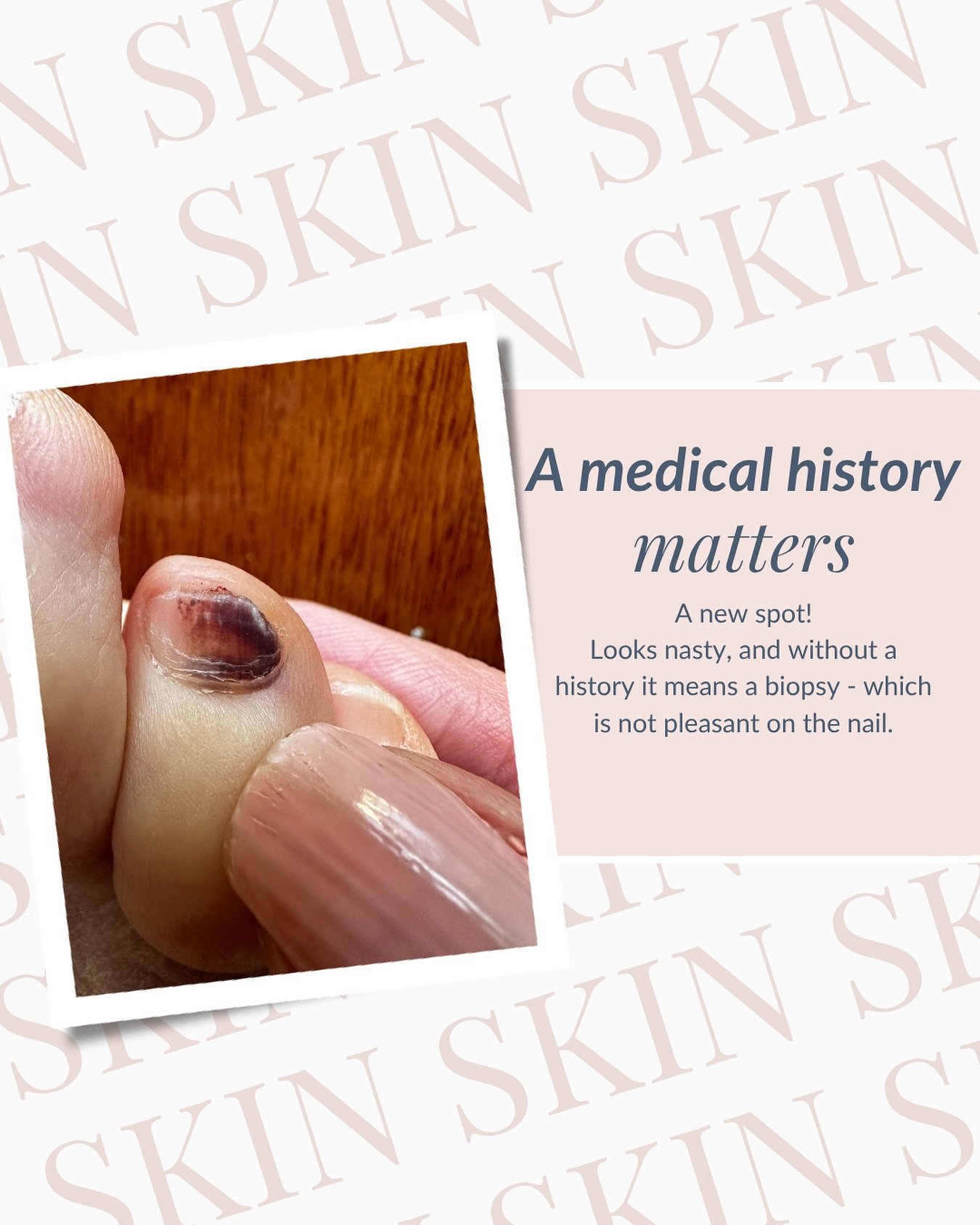 After a thorough history was taken, this &ldquo;melanoma&rdquo; turned out to be a simple bruise from a forgotten weekend hike. Never underestimate the power of your story&mdash;what seems irrelevant could be the missing puzzle piece. 
🌟
So, when yo