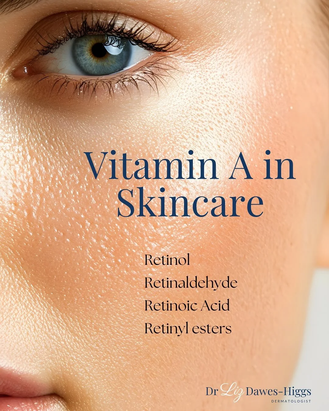 Vitamin A is one of the most effective ingredients in skin health and anti-ageing.
🌟 
But the terminology can be confusing so here&rsquo;s what you need to know. 
🌟
Vitamin A comes in several forms - retinol, retinaldehyde, retinoic acid and retina
