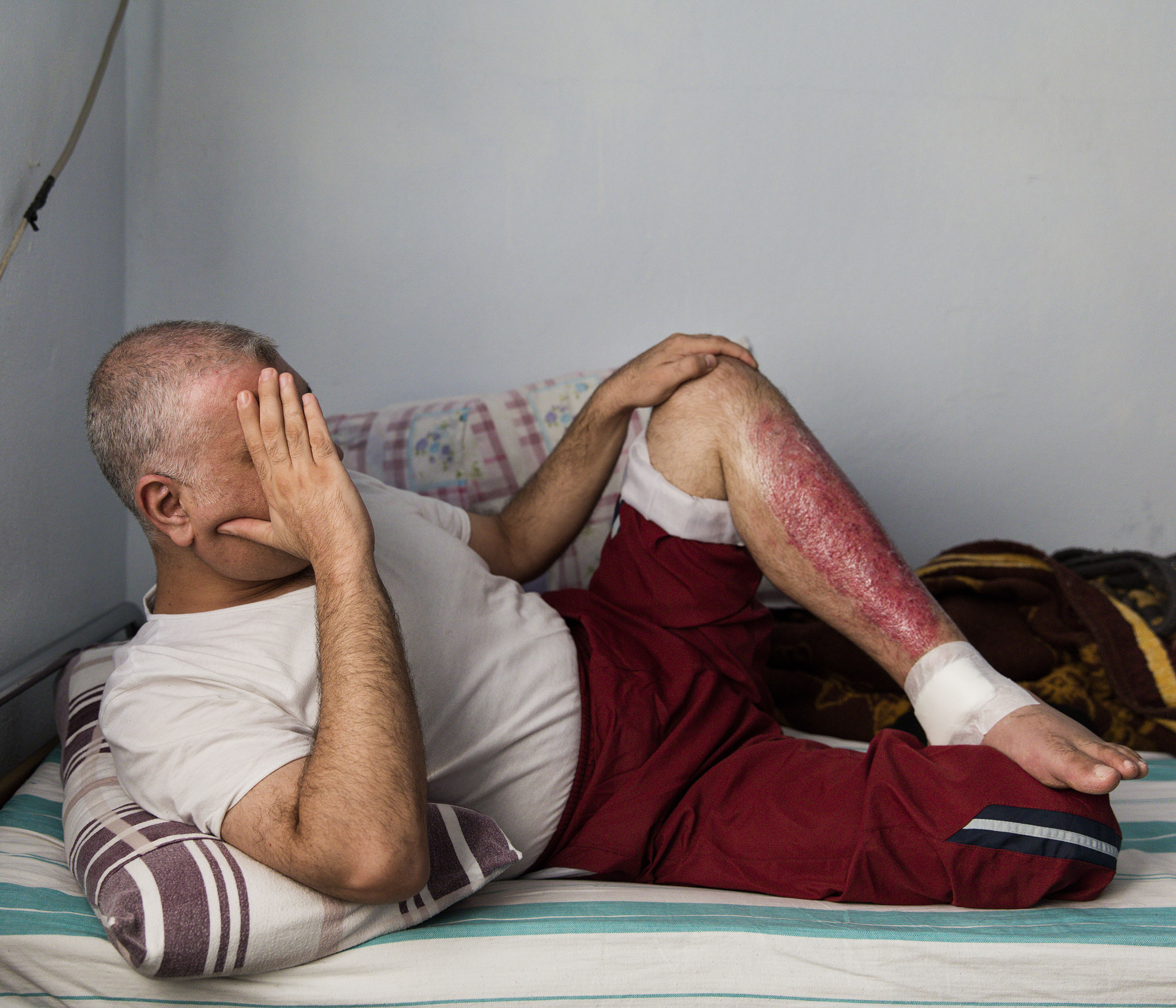  A Syrian lawyer from Idlib sits for a portrait at a small medical clinic inside Turkey where he was being treated for various injuries after a Russian airstrike that targeted the courthouse in Idlib in December 2015. 