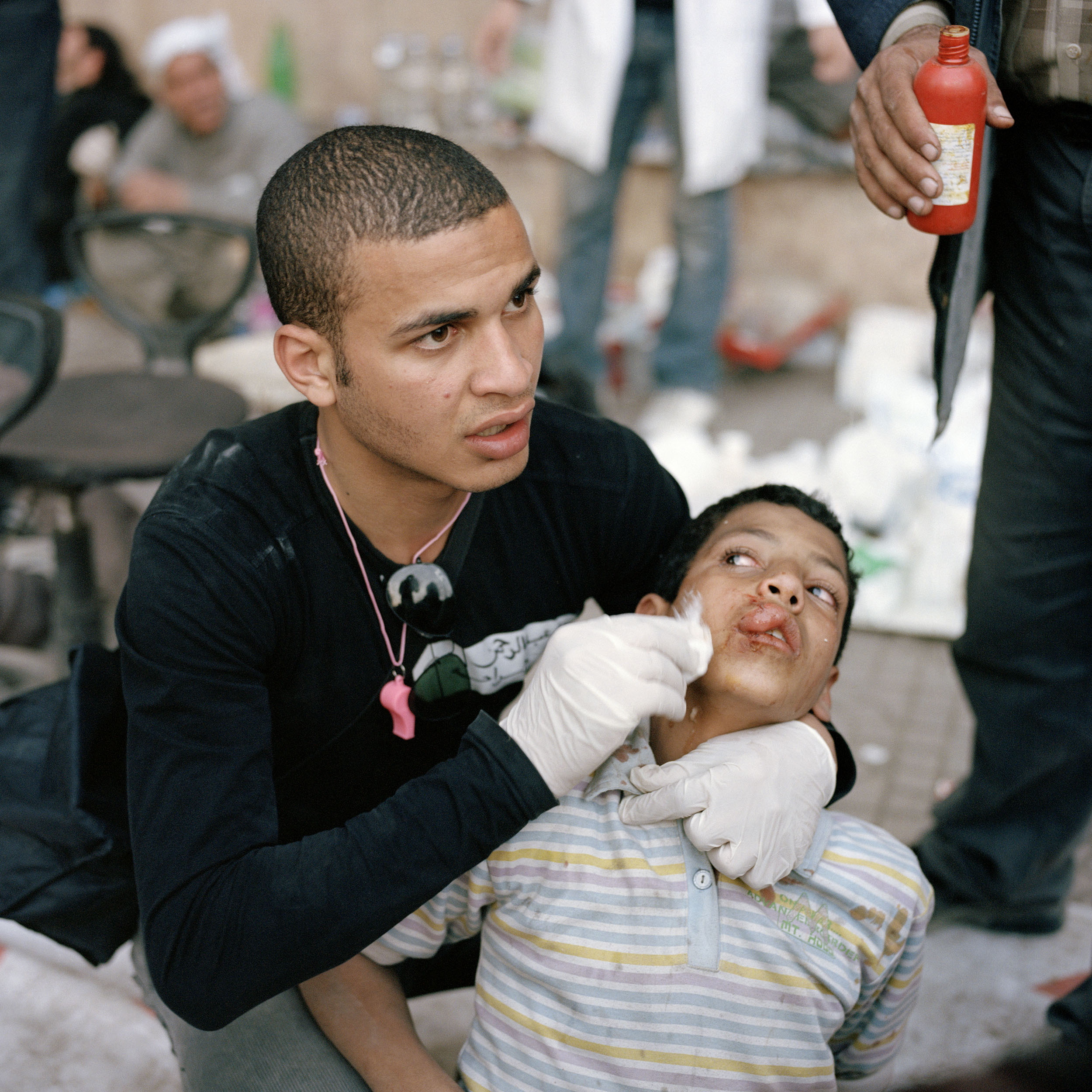  A volunteer medic in Tahrir square treats a young boy who was allegedly caught while fighting for supporters of Mubarak. Although badly stunned by a stone that hit him in the face, when the boy came to  he was terrified to find he had been captured 