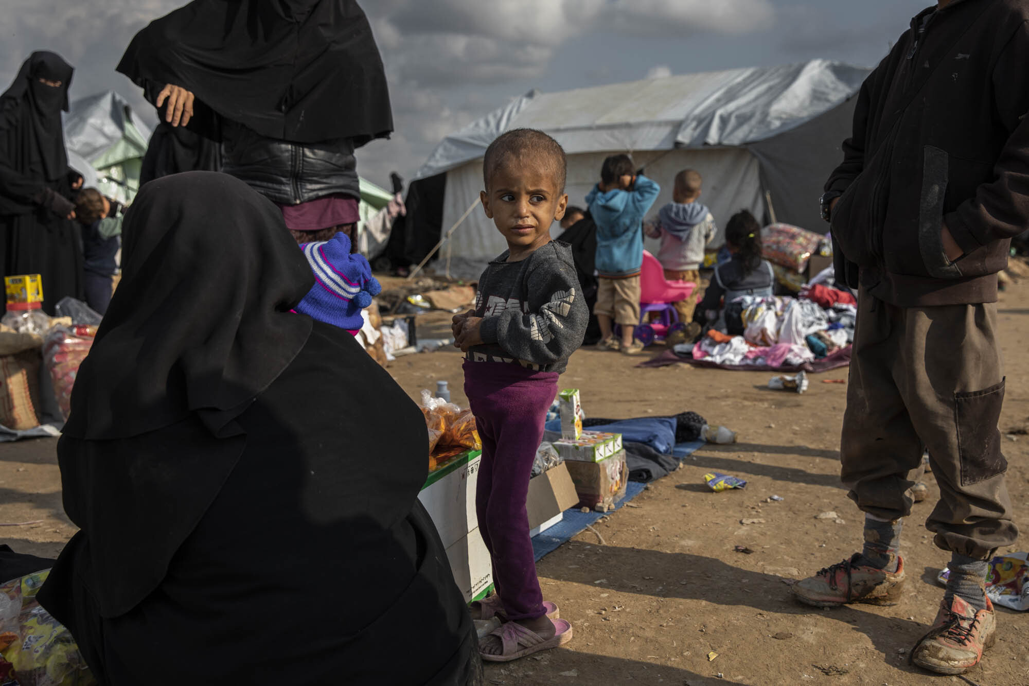  A malnourished child who had escaped the last ISIS-held area in south east Syria, stood in the foreigners section at al-Hol detention camp in Kurdish controlled northern Syria.  