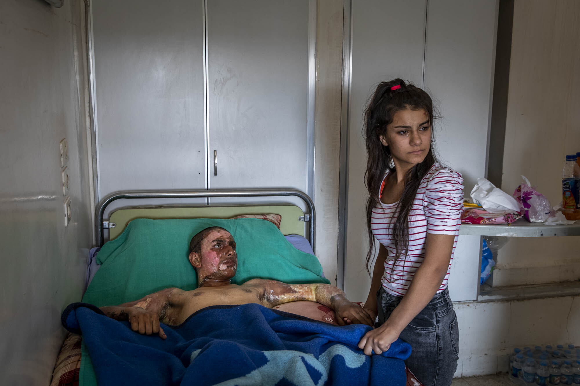  A young Kurdish SDF fighter was visited by his girlfriend for the first time, after he had been badly burnt during a battle with Turkish forces on the Syrian-Turkish border several days before. Initially she was unable to enter the room because she 