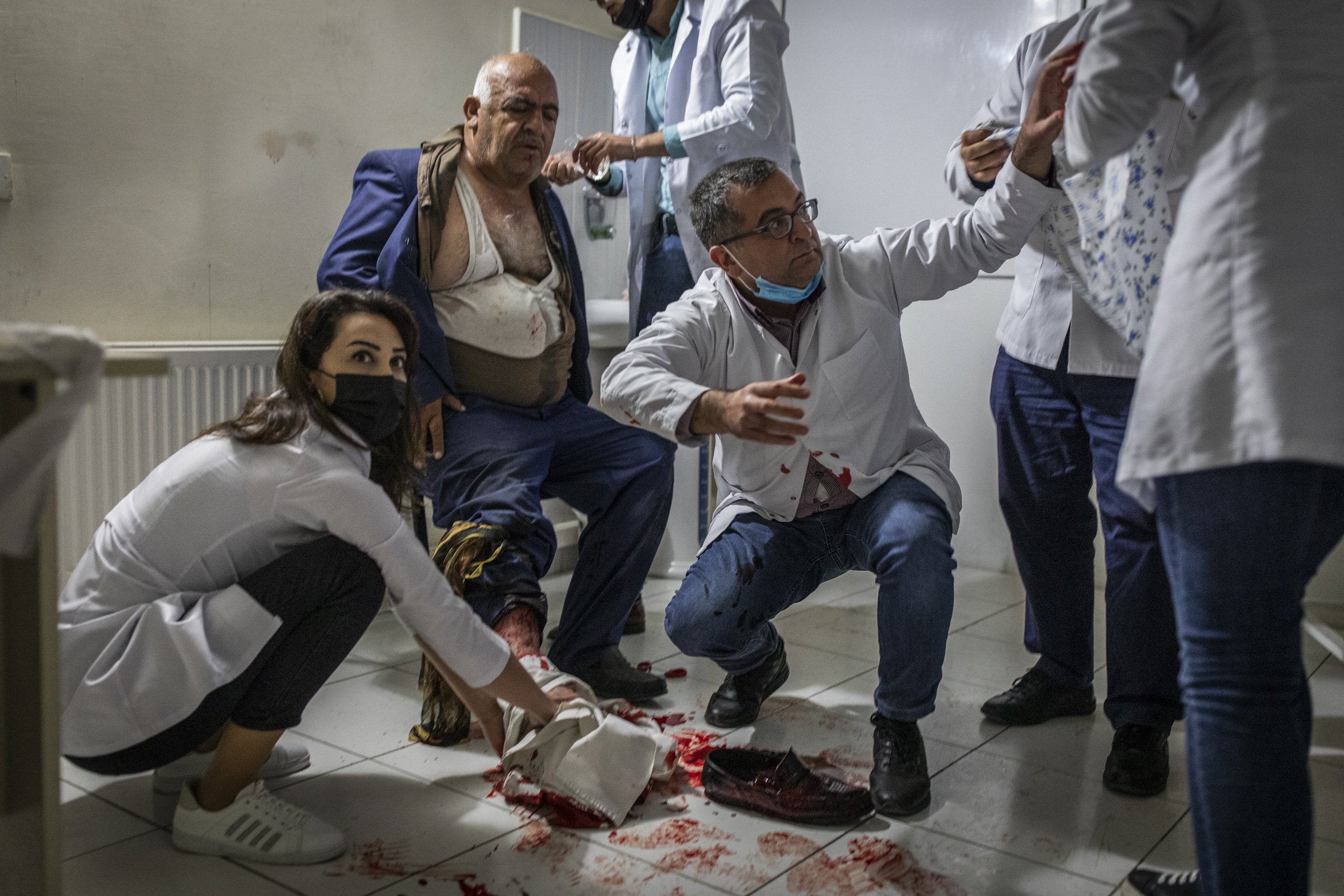 Doctors and nurses tended to a taxi driver who had been injured in a rocket attack launched by Armenian forces on the city of Barda in Azerbaijan.
