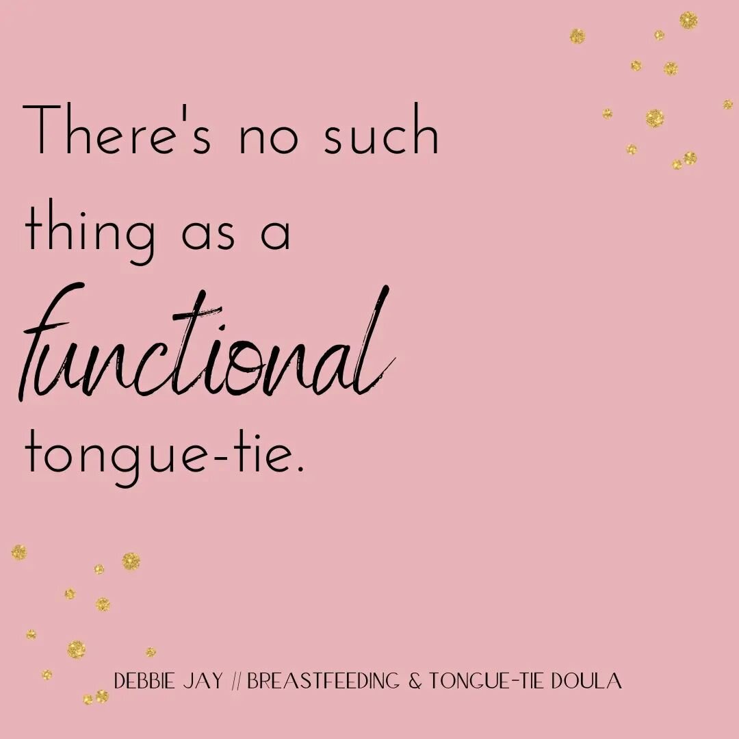 There's no such thing as a 'functional tongue-tie'. The 'functional' label frustrates me as much as 'mild', 'small', and the other common labels.

A tongue-tie is, by definition, a restriction under the tongue, inhibiting the range of movement of the