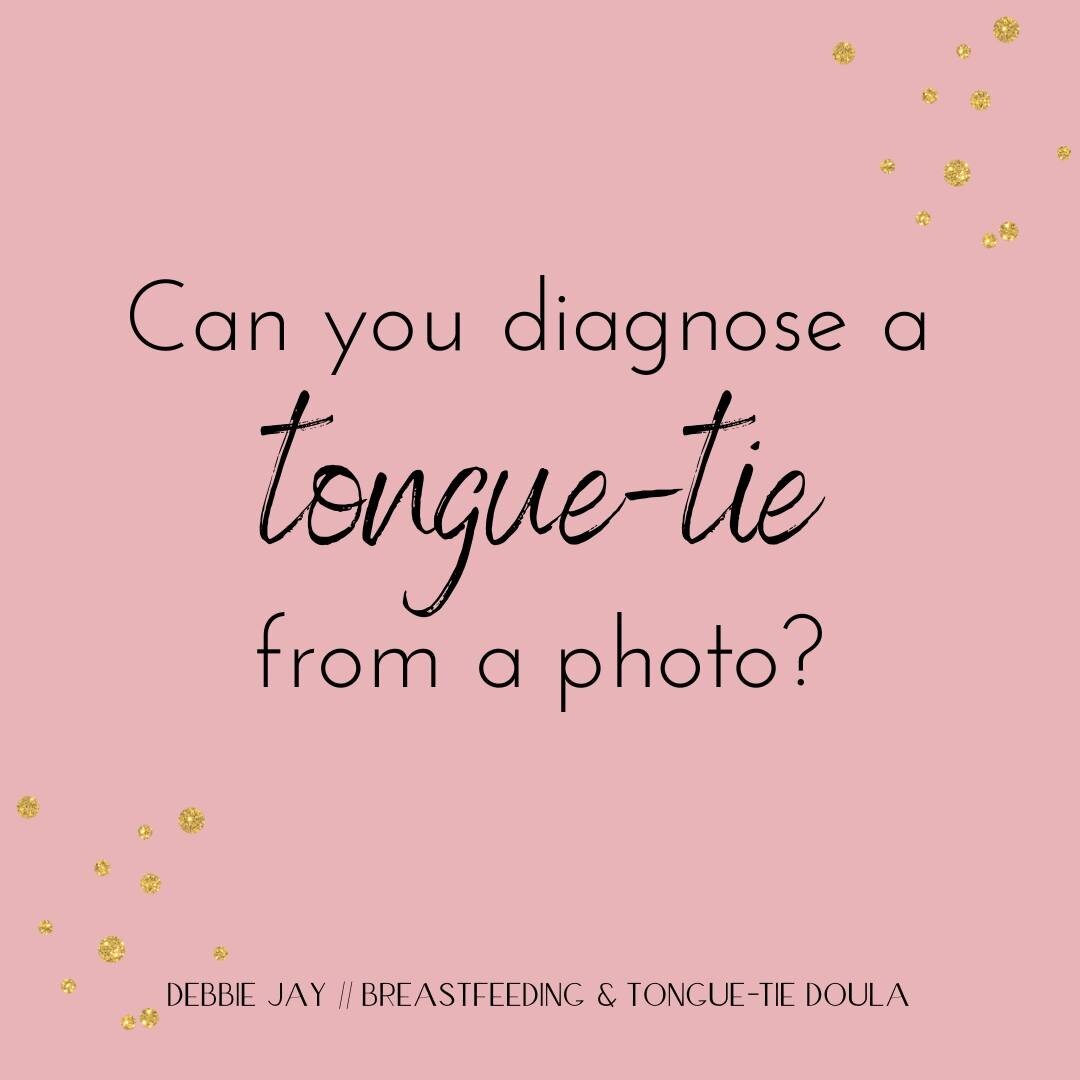 Can you diagnose a tongue-tie from a photo? It's a contentious topic!

The short answer is: no. But not for the reasons commonly given in support groups. 

Firstly, when someone posts a photo of their child's tongue anywhere online, the people commen