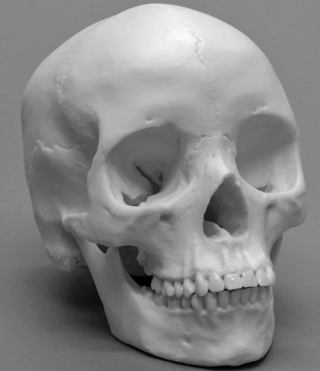 Orbital Diseases