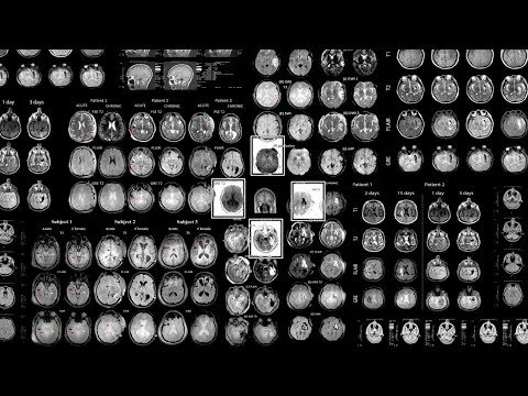 Accelerating discovery: The USC Mark and Mary Stevens Neuroimaging and Informatics Institute (Copy)