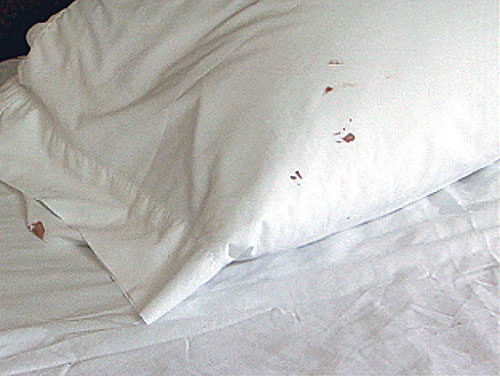 bed bug stains on mattress