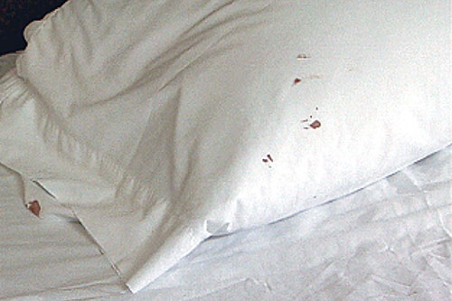 How To Check Your Bedroom For Bed Bugs, Do Bed Bugs Hide In Quilt