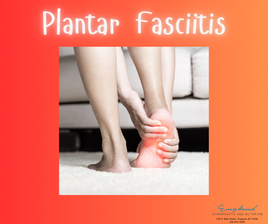 Plantar Fasciitis
