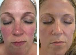 Omni Signature Facial