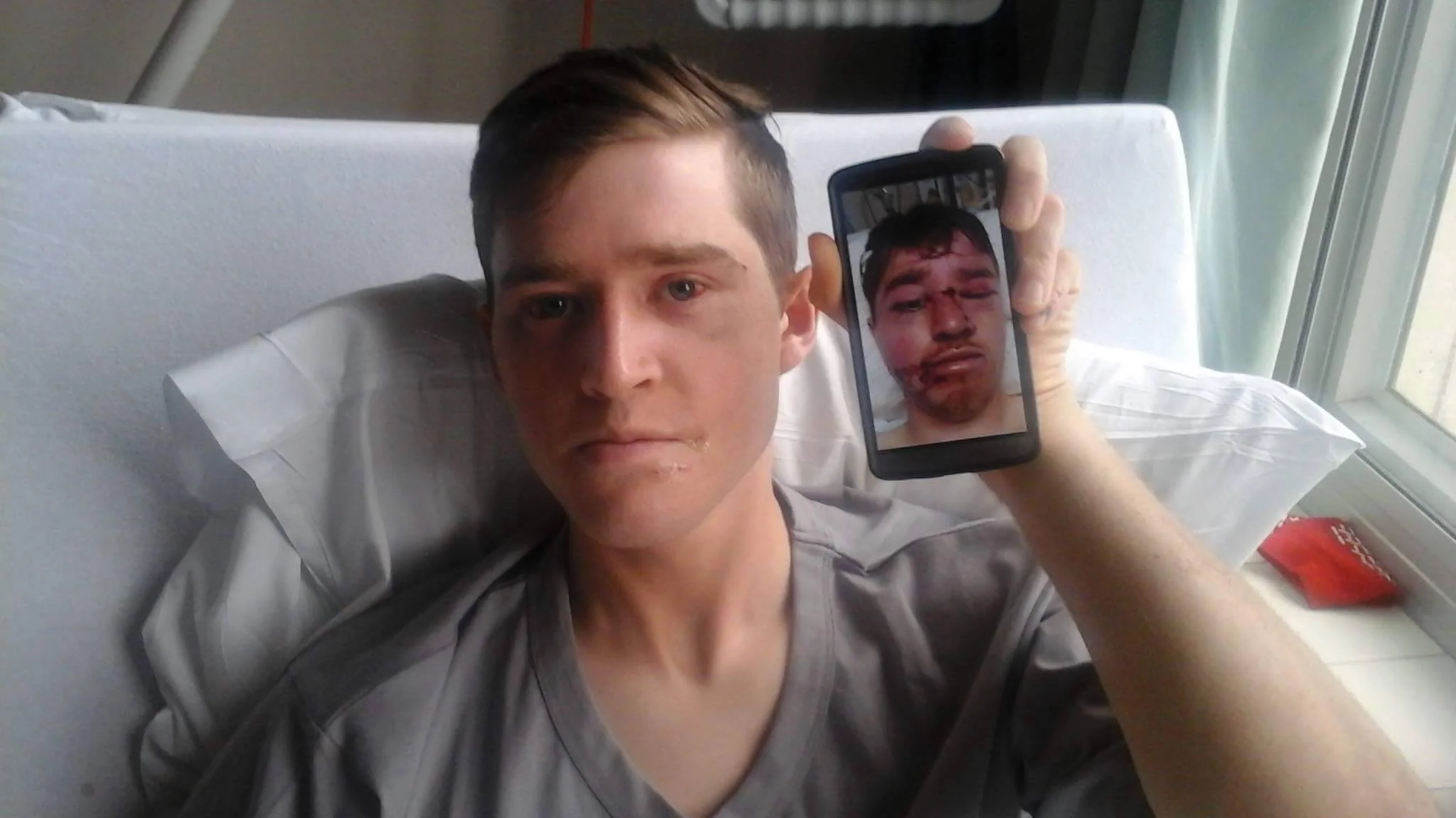 A year later: reflections on a life-changing climbing accident