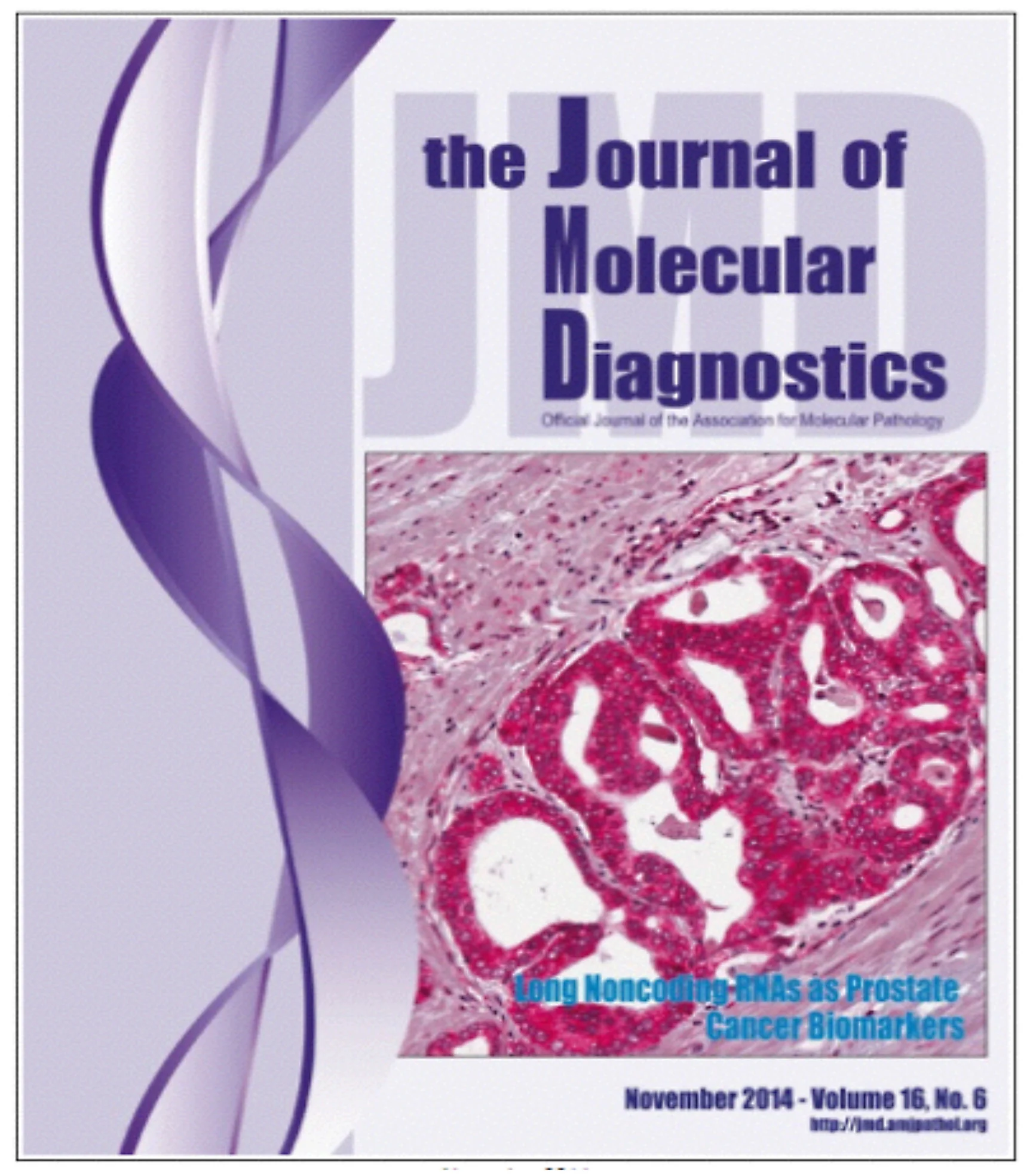 Prostate Cancer Research is the focus of the Journal of Molecular Diagnostic in November