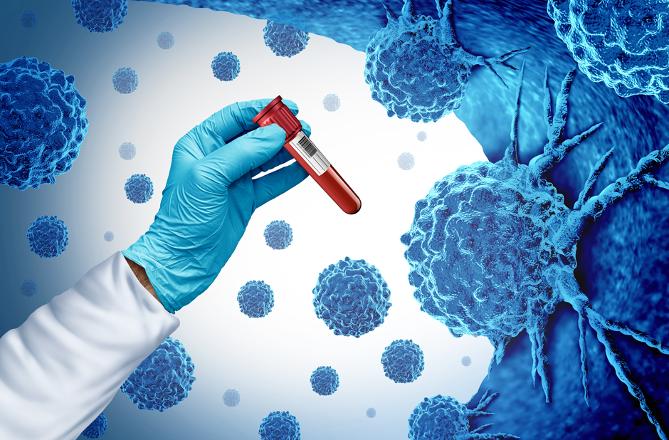 What’s new in immunotherapy for prostate cancer?