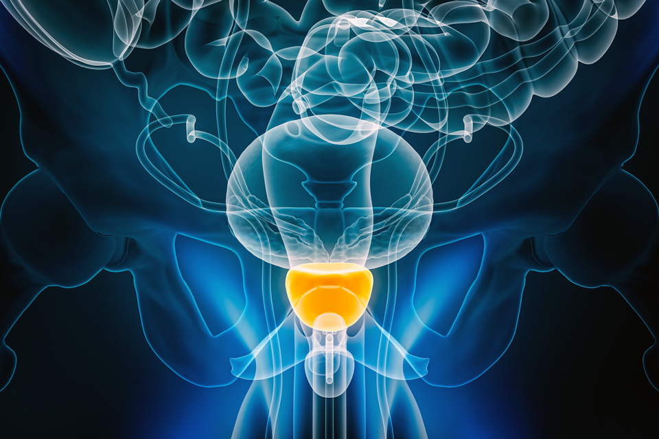 Advances in Prostate Cancer Research — Where things are.