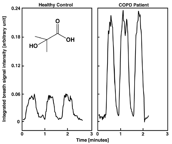 Identification of COPD via secondary electrospray ionization high resolution mass spectrometry.png