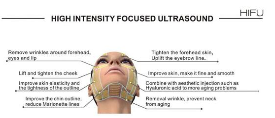 HIFU.PNG