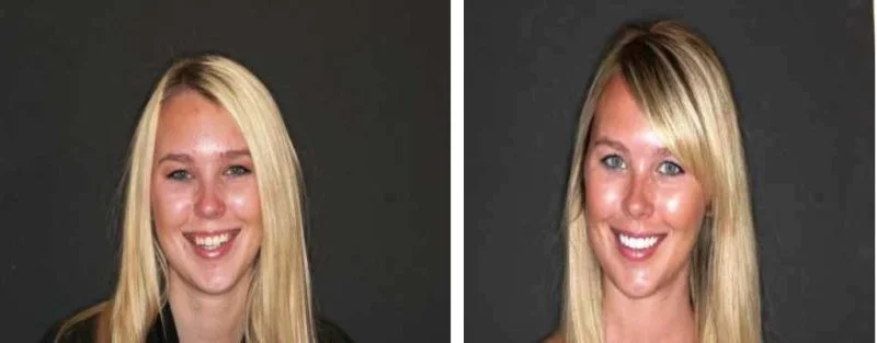  Head shot of previous case 