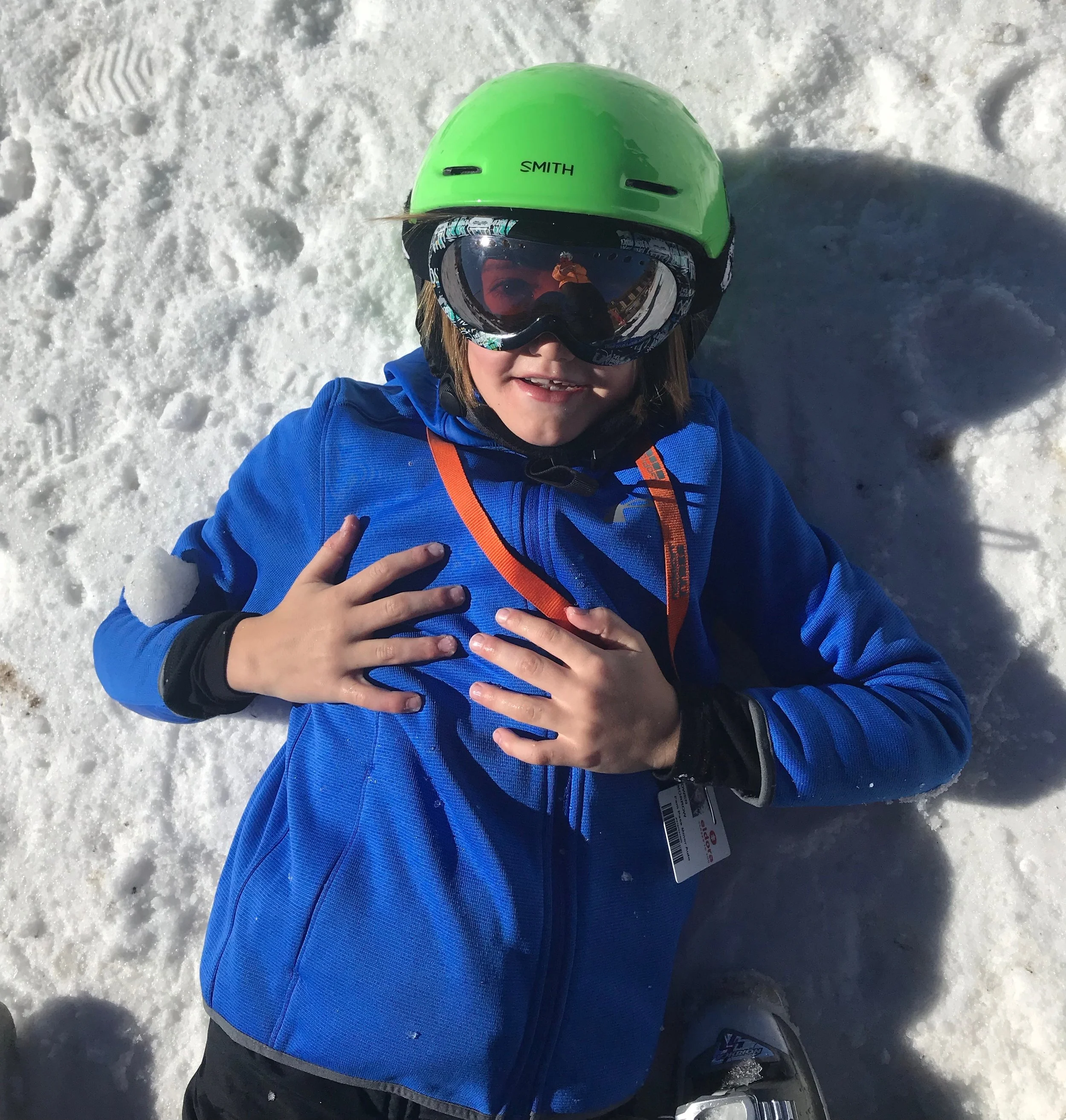 Wear sunscreen in the winter, especially in the snow!