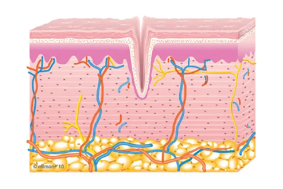 1. Untreated Skin