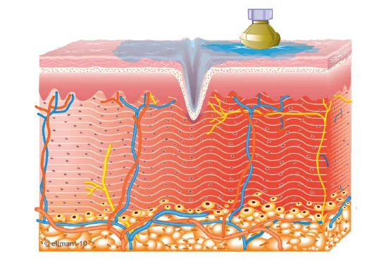 2. Collagen Synthesis Begins
