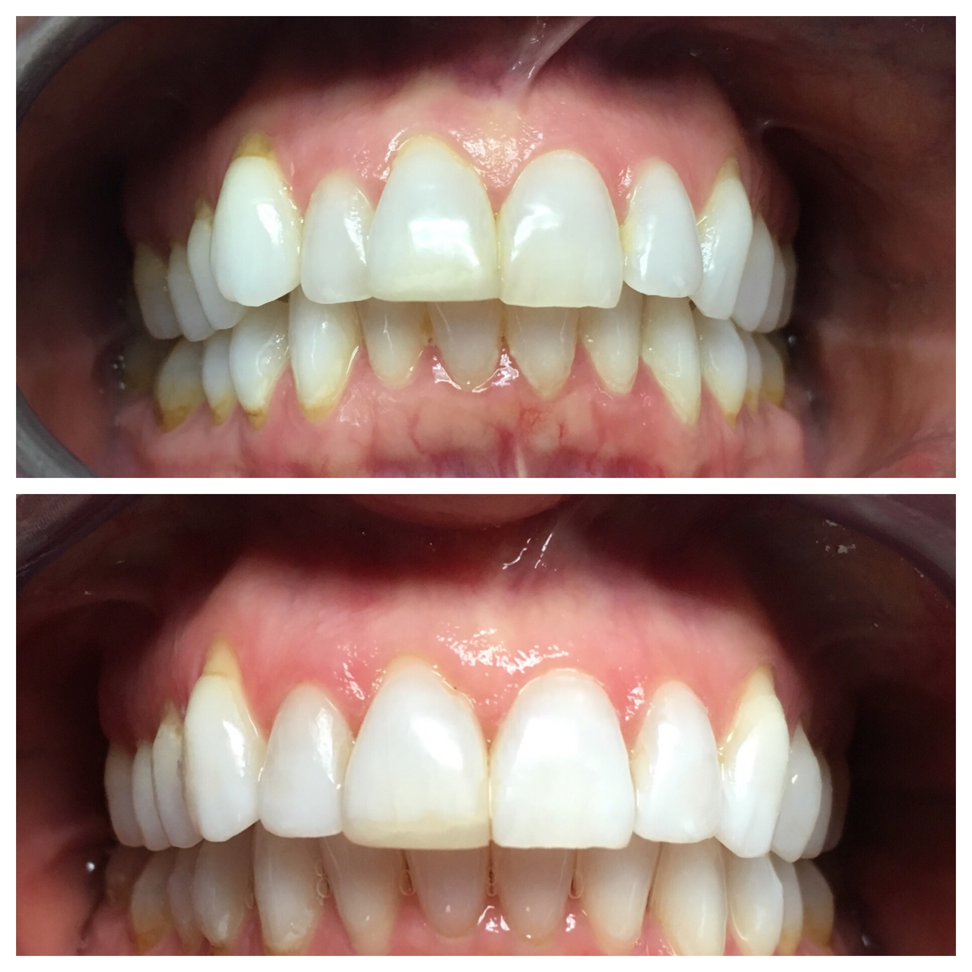 This patient was treated in under 12 months